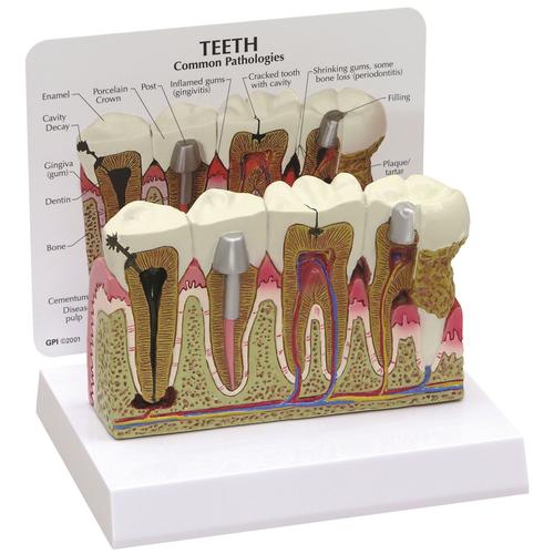 Image 2 - TEETH MODEL