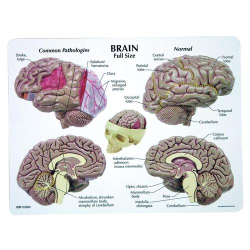 Image 2 - BRAIN MODEL