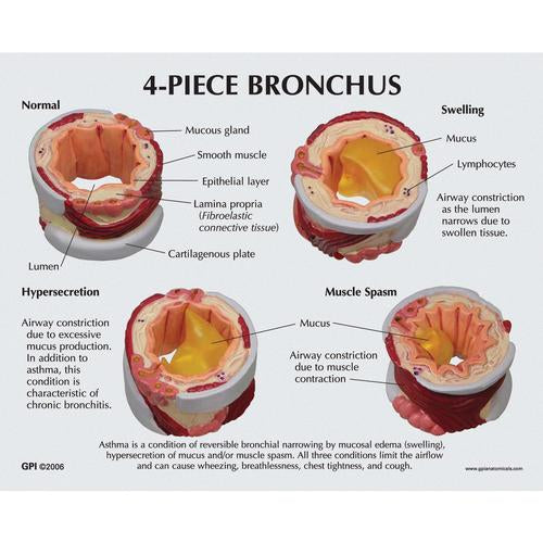 Image 4 - 4-PIECE BRONCHUS MODEL