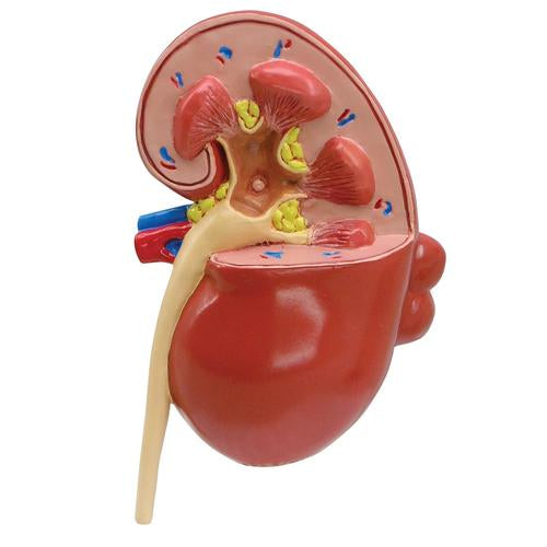 Image 2 - DISEASED KIDNEY MODEL