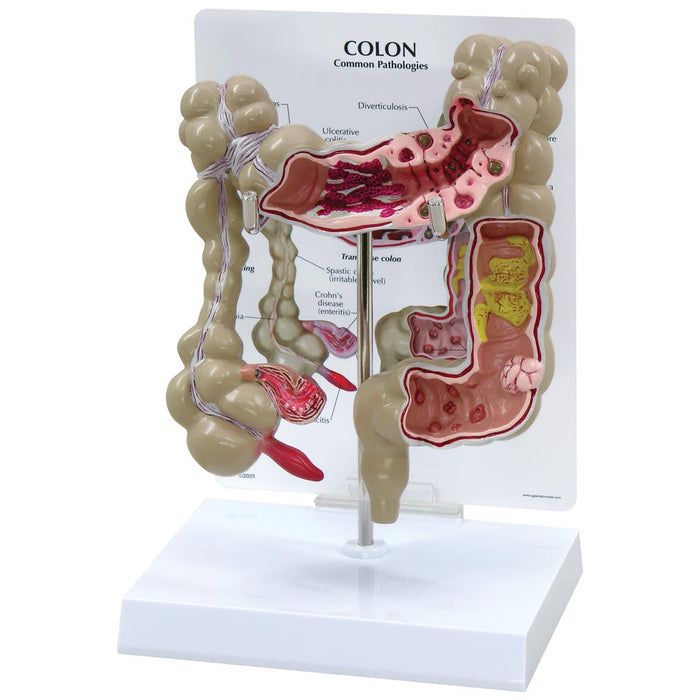 Colon Model