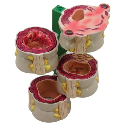 GI Tract Model — Health Simulation