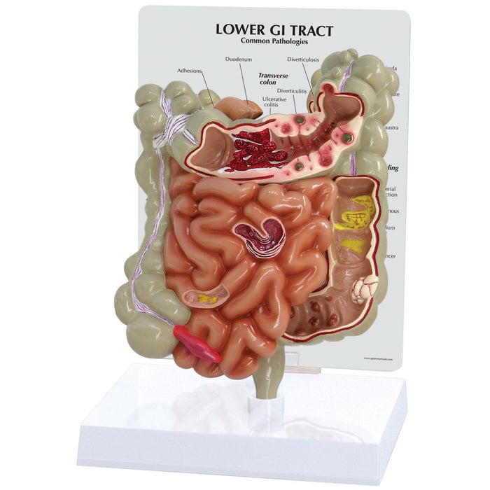 GI Tract Model