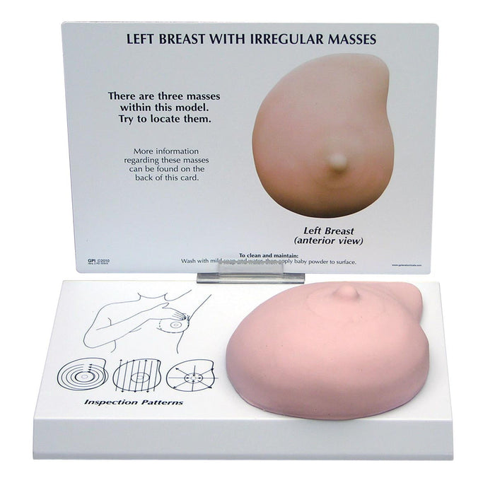 Left Breast Model with Irregular Masses