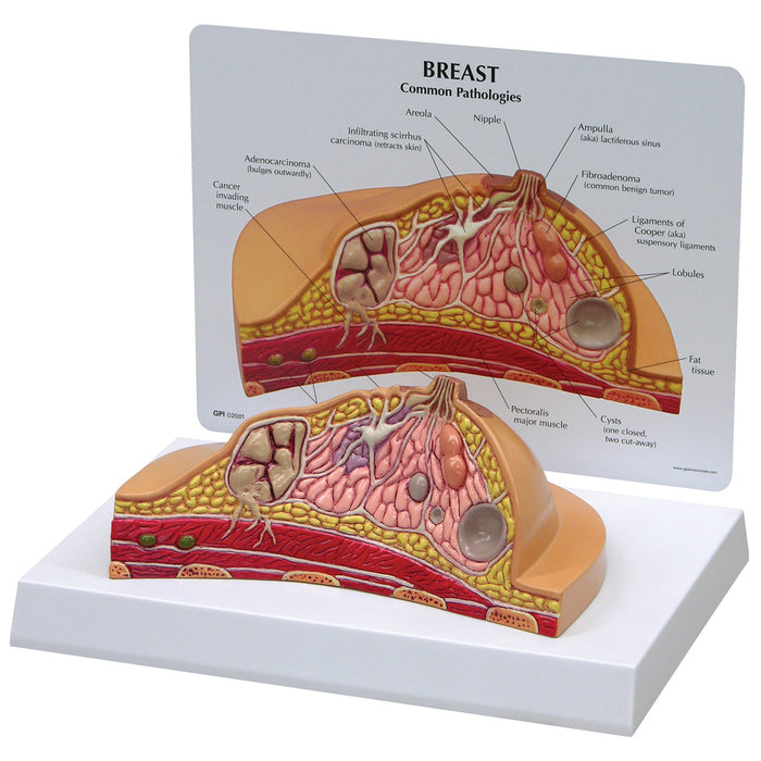 Breast Cross-Section Model