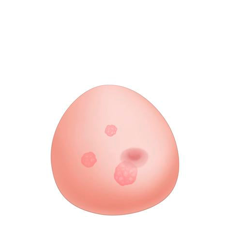 Image 3 - SONOTRAIN™ BREAST MODEL WITH TUMOURS