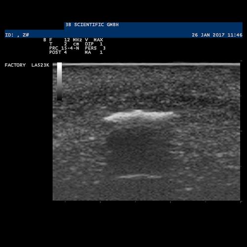 Image 6 - SONOTRAIN™ FOREIGN BODY MODEL