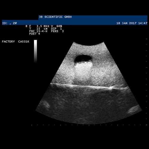 Image 5 - SONOTRAIN™ ULTRASOUND VEIN MODEL