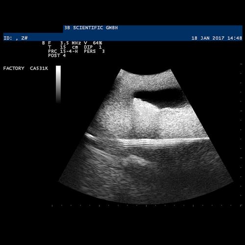 Image 6 - SONOTRAIN™ ULTRASOUND VEIN MODEL