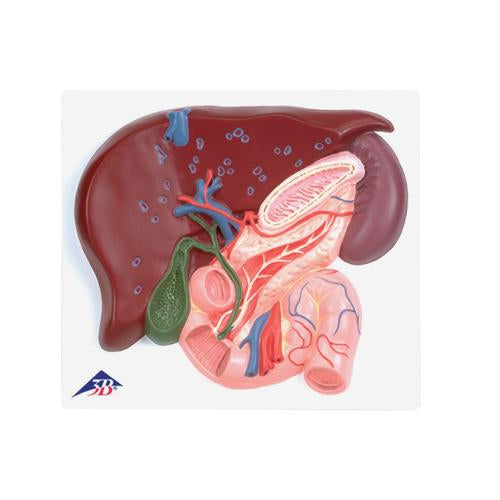 Image 5 - GALLBLADDER SET