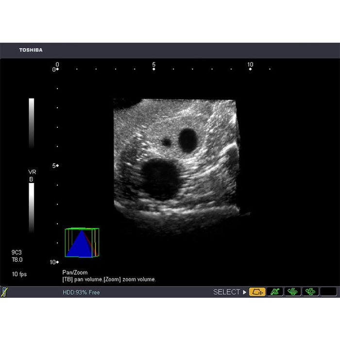 Image 3 - COMBINATION IUP ECTOPIC PREGNANCY TRANSVAGINAL ULTRASOUND TRAINING MODEL