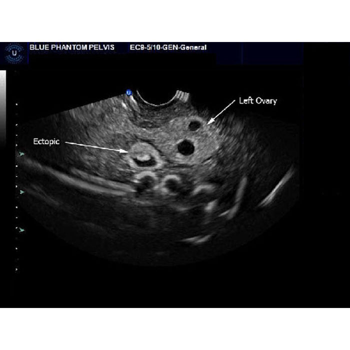 Image 4 - COMBINATION IUP ECTOPIC PREGNANCY TRANSVAGINAL ULTRASOUND TRAINING MODEL
