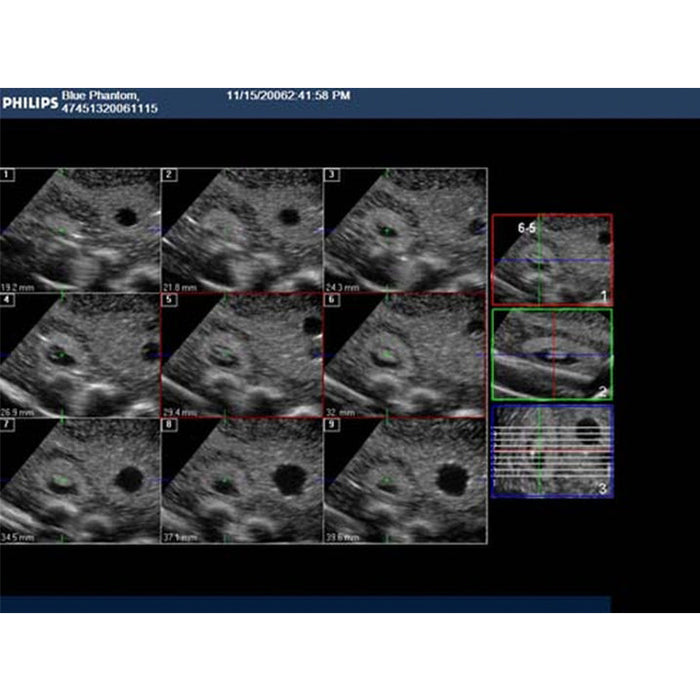 Image 5 - COMBINATION IUP ECTOPIC PREGNANCY TRANSVAGINAL ULTRASOUND TRAINING MODEL