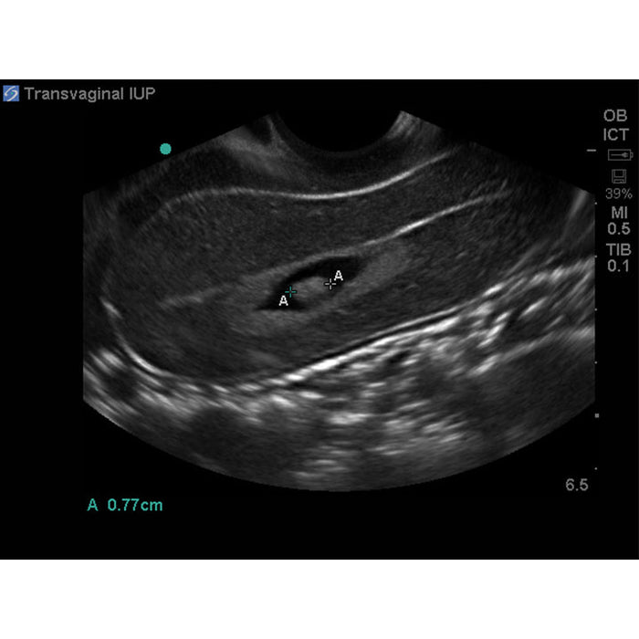 Image 6 - COMBINATION IUP ECTOPIC PREGNANCY TRANSVAGINAL ULTRASOUND TRAINING MODEL