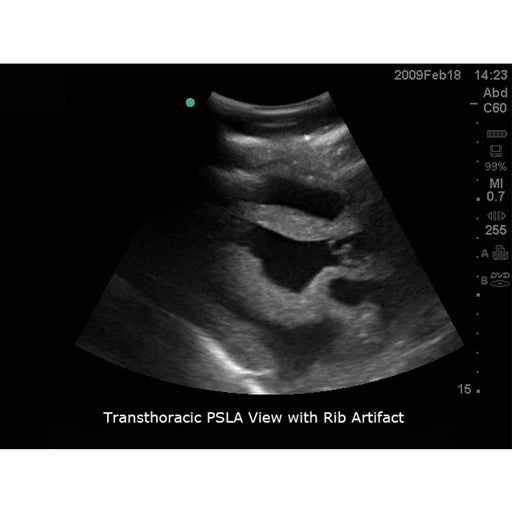 Image 2 - TRANSTHORACIC ECHOCARDIOGRAPHY AND PERICARDIOCENTESIS ULTRASOUND TRAINING MODEL, WITH HEAD