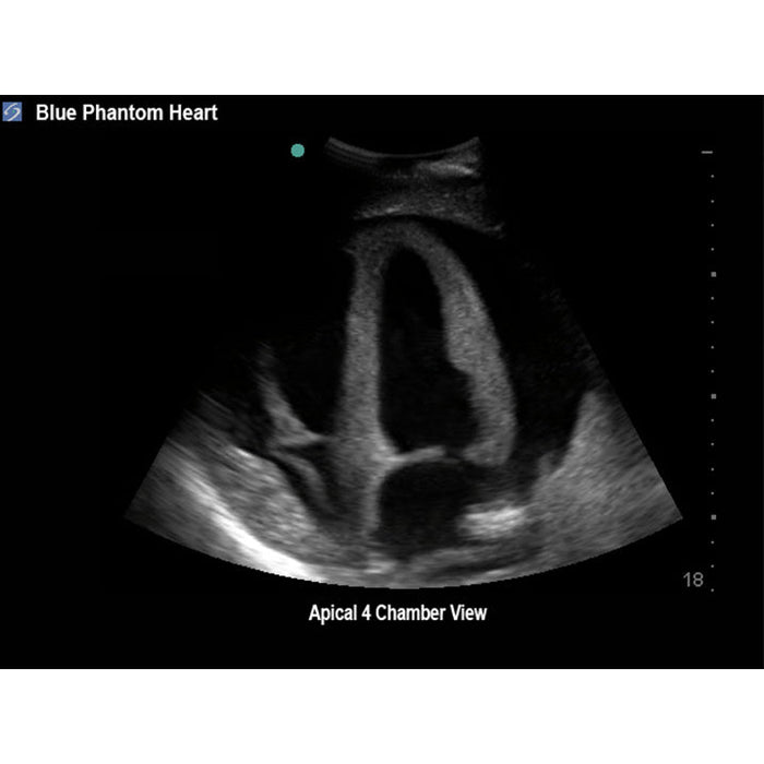 Image 4 - TRANSTHORACIC ECHOCARDIOGRAPHY AND PERICARDIOCENTESIS ULTRASOUND TRAINING MODEL, WITH HEAD