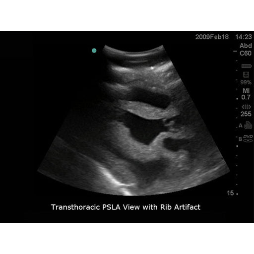 Image 2 - FAST EXAM REAL TIME ULTRASOUND TRAINING MODEL