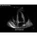 Image 3 - FAST EXAM REAL TIME ULTRASOUND TRAINING MODEL