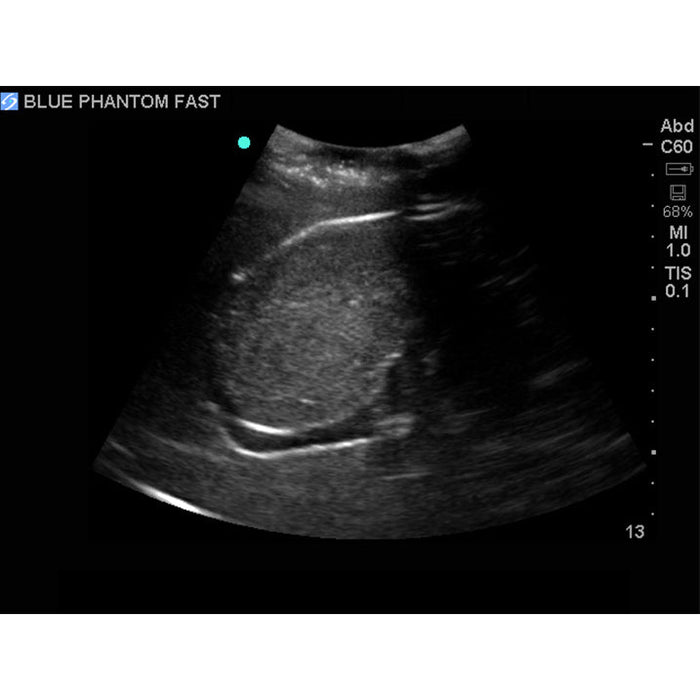 Image 5 - FAST EXAM REAL TIME ULTRASOUND TRAINING MODEL