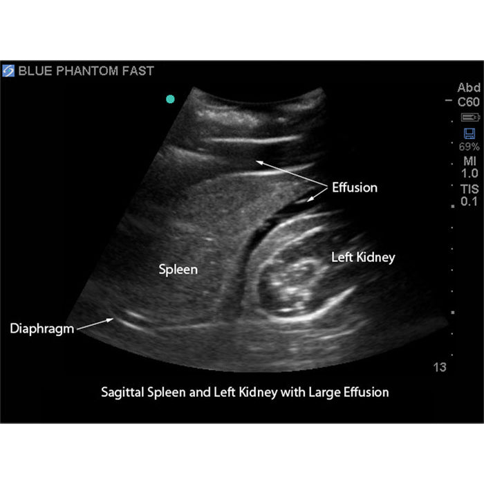 Image 6 - FAST EXAM REAL TIME ULTRASOUND TRAINING MODEL