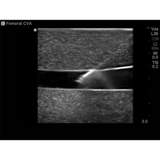 Image 2 - LEG MODEL WITH FEMORAL AND SAPHENOUS VEIN VENOUS ACCESS FOR ULTRASOUND TRAINING, NO DVT