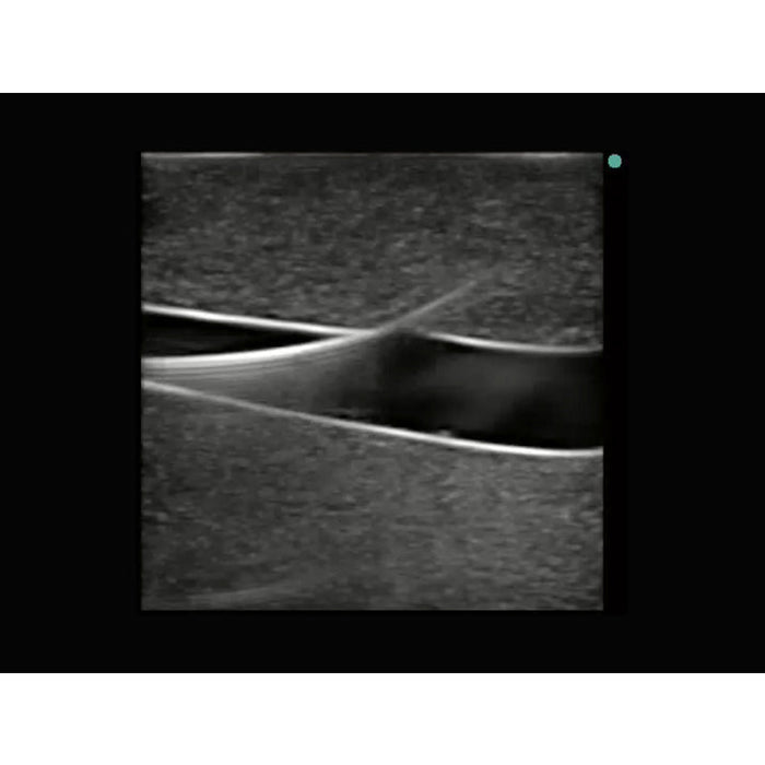 Image 3 - LEG MODEL WITH FEMORAL AND SAPHENOUS VEIN VENOUS ACCESS FOR ULTRASOUND TRAINING, NO DVT