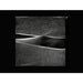 Image 3 - LEG MODEL WITH FEMORAL AND SAPHENOUS VEIN VENOUS ACCESS FOR ULTRASOUND TRAINING, NO DVT