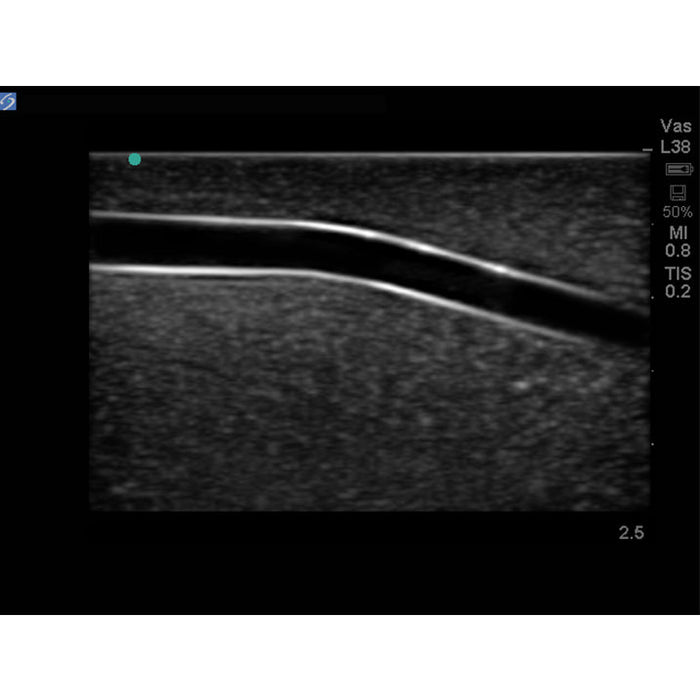 Image 4 - LEG MODEL WITH FEMORAL AND SAPHENOUS VEIN VENOUS ACCESS FOR ULTRASOUND TRAINING, NO DVT