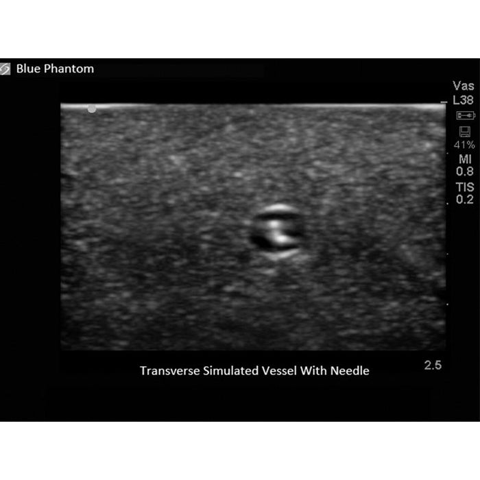 Image 5 - LEG MODEL WITH FEMORAL AND SAPHENOUS VEIN VENOUS ACCESS FOR ULTRASOUND TRAINING, NO DVT