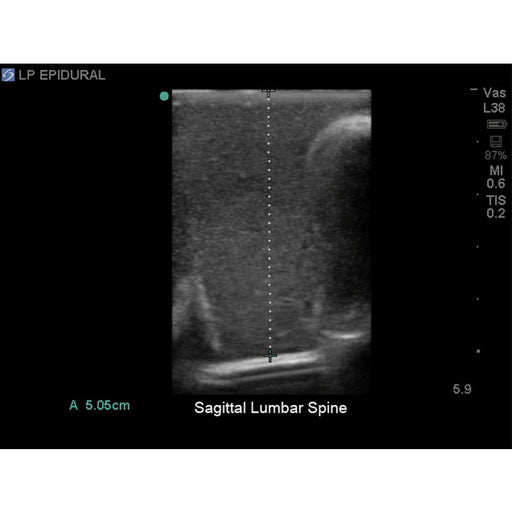 Image 2 - LUMBAR PUNCTURE AND SPINAL EPIDURAL WITH THORACIC EPIDURAL ULTRASOUND TRAINING MODEL