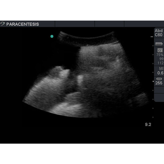 Image 3 - PARACENTESIS ULTRASOUND TRAINING MODEL WITH FEMORAL NERVES, WITH FEMORAL VESSELS