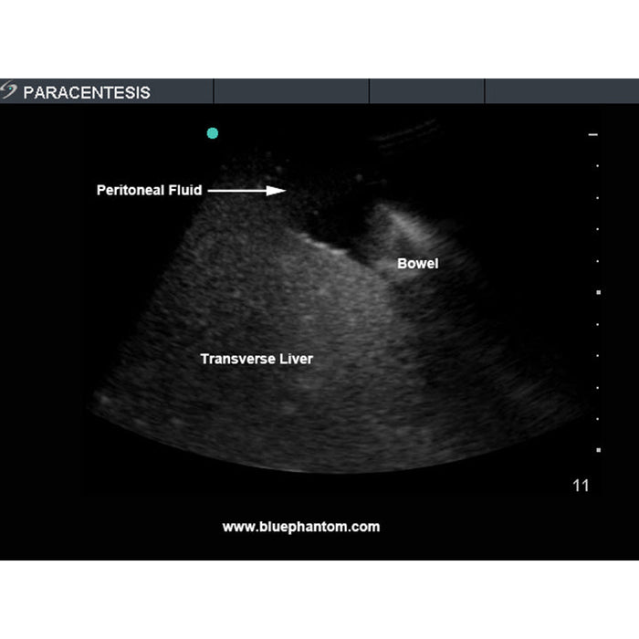 Image 4 - PARACENTESIS ULTRASOUND TRAINING MODEL WITH FEMORAL NERVES, WITH FEMORAL VESSELS