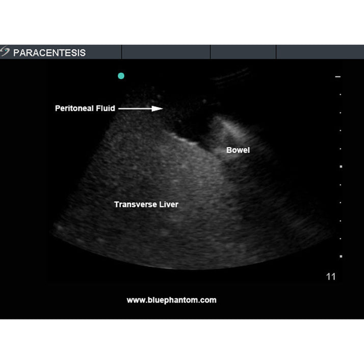 Paracentesis Ultrasound Training Model With Femoral Nerves, With Femor ...