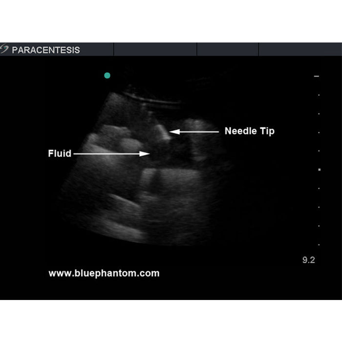 Image 5 - PARACENTESIS ULTRASOUND TRAINING MODEL WITH FEMORAL NERVES, WITH FEMORAL VESSELS