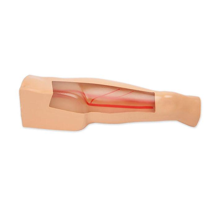 Advanced Sclerotherapy Ultrasound Training Model, With Flesh Tone Tissue Inserts