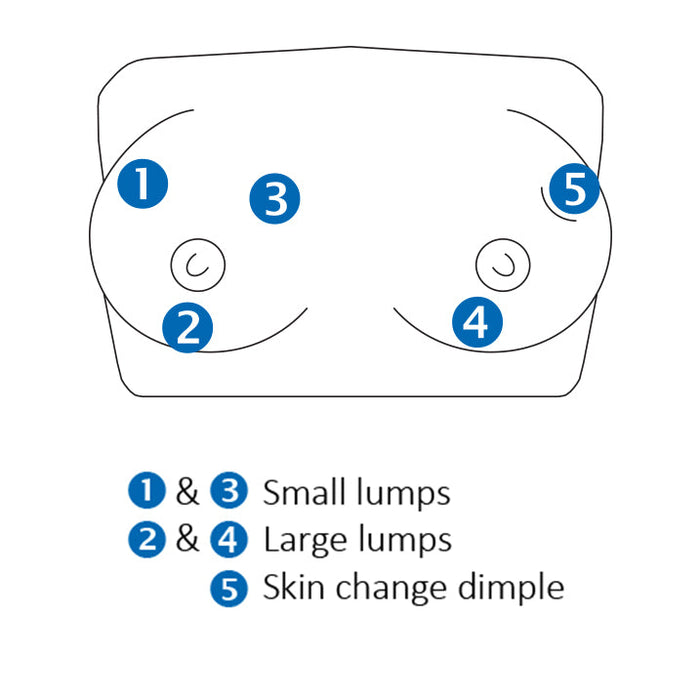 Image 2 - BREAST SELF-EXAMINATION TRAINING MODEL