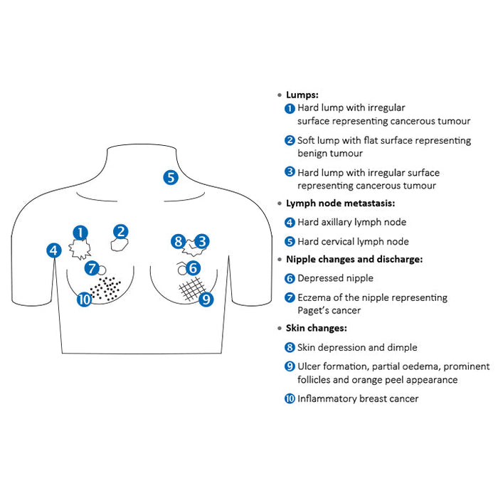 Image 2 - BREAST CANCER TRAINING MODEL