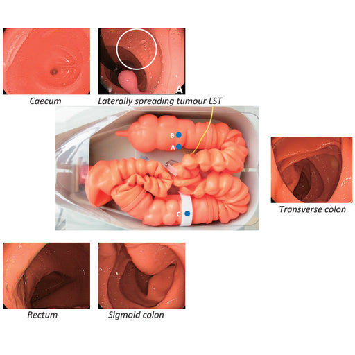 Image 2 - COLONOSCOPY (LOWER GI ENDOSCOPY) SIMULATOR TYPE II