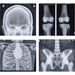 Image 3 - X-RAY/RADIOGRAPHIC POSITIONING DOLL