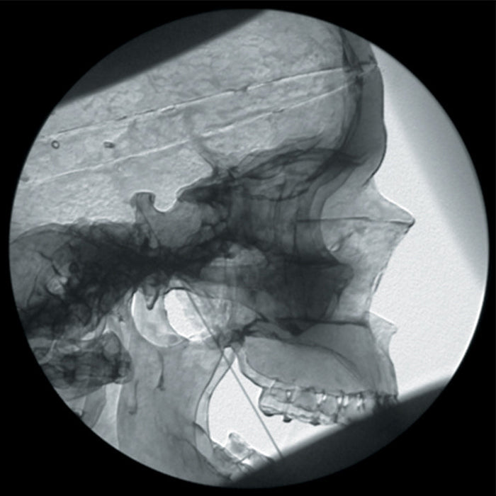 Image 2 - NERVE BLOCK/PAIN RELIEF MANIKIN