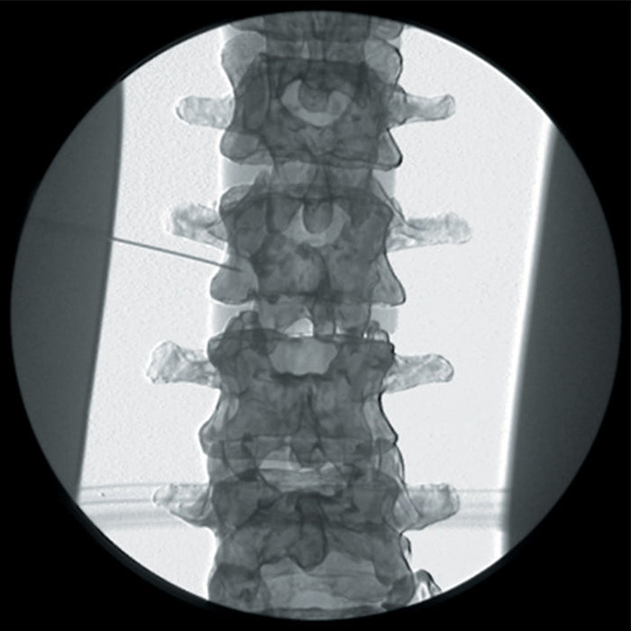 Image 3 - NERVE BLOCK/PAIN RELIEF MANIKIN