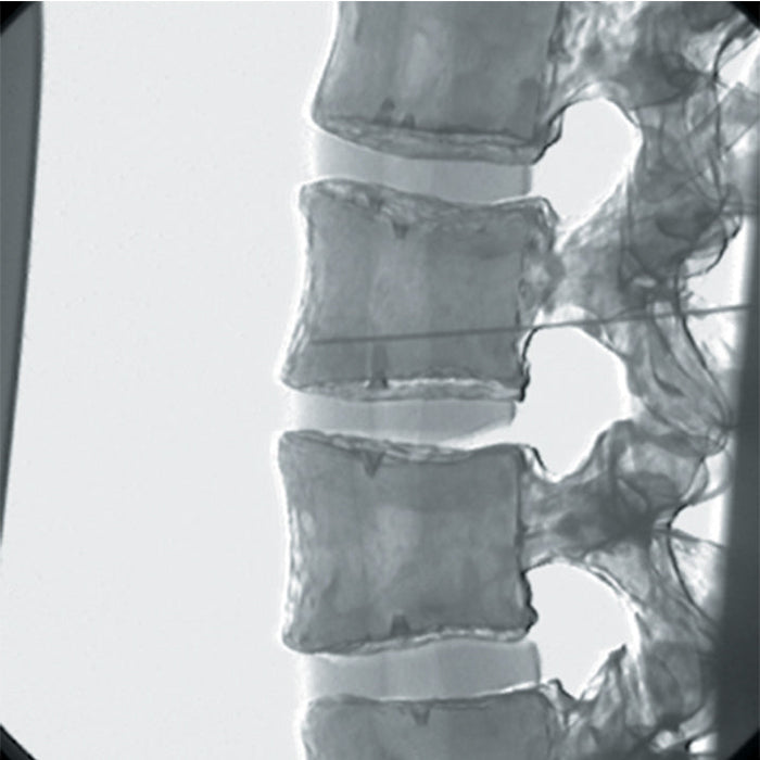 Image 5 - NERVE BLOCK/PAIN RELIEF MANIKIN