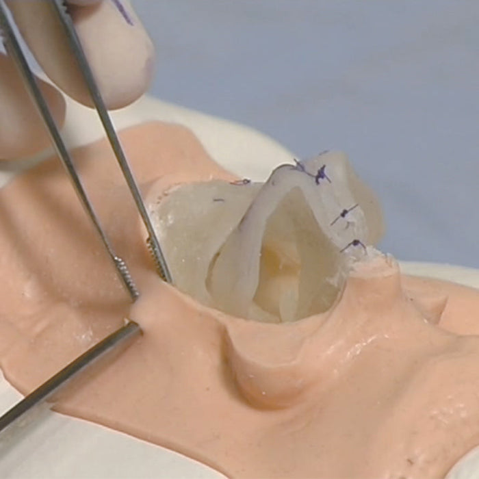 Image 4 - RHINOPLASTY MODEL