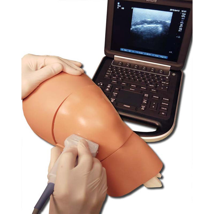 Image 3 - ARTHROCENTESIS MODEL