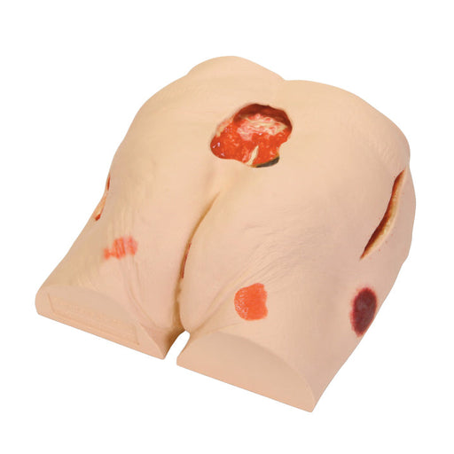 Image 2 - WOUND CARE MODEL, WHITE