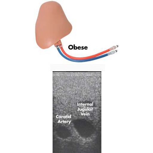 Image 2 - CENTRALINEMAN OBESE REPLACEABLE TISSUE