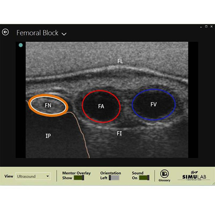 Image 3 - REGIONAL ANESTHESIA FEMORAL TRAINER WITH SMARTISSUE