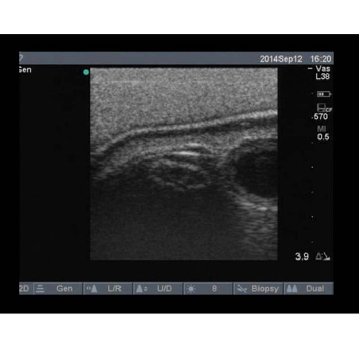 Image 5 - REGIONAL ANESTHESIA FEMORAL TRAINING PACKAGE