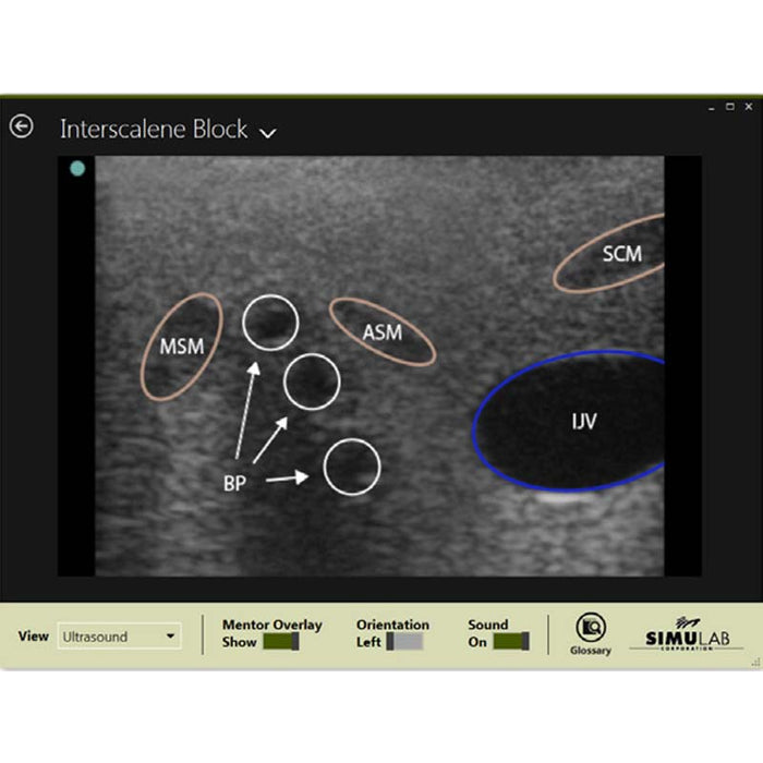 Image 3 - REGIONAL ANESTHESIA WITH SMARTISSUE TRAINING PACKAGE