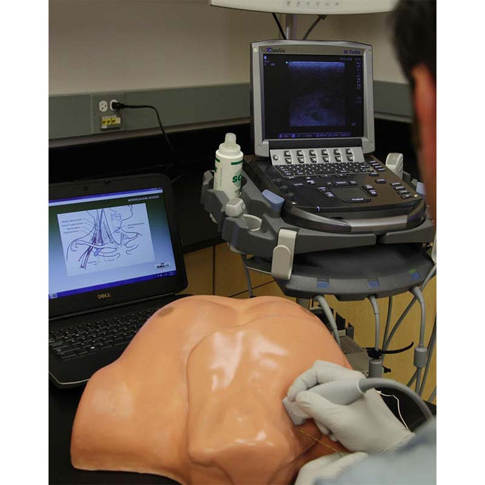 Image 2 - REGIONAL ANESTHESIA WITH SMARTISSUE TRAINING PACKAGE & ARTICULATING HEAD